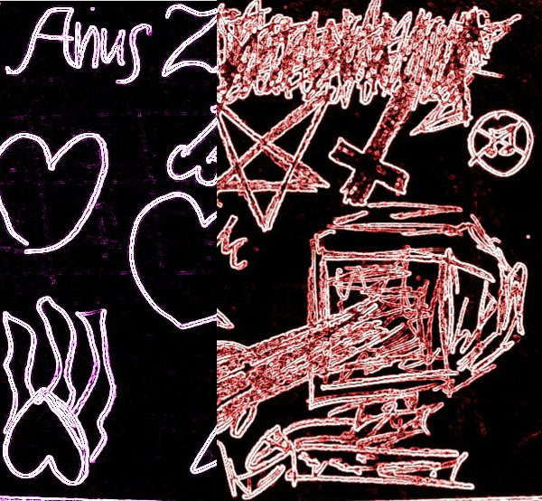 ANUS ZAPEKANUS - WINTER IS GAY