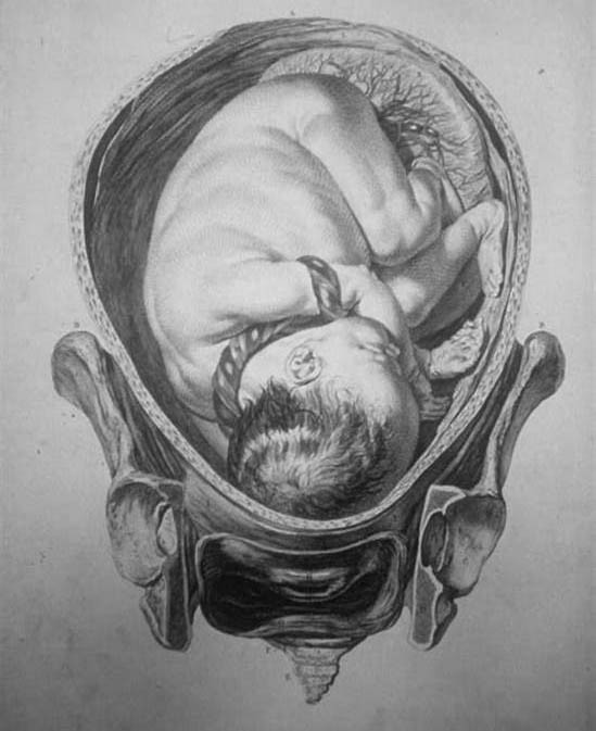 Alas Lust Garden - Untitled