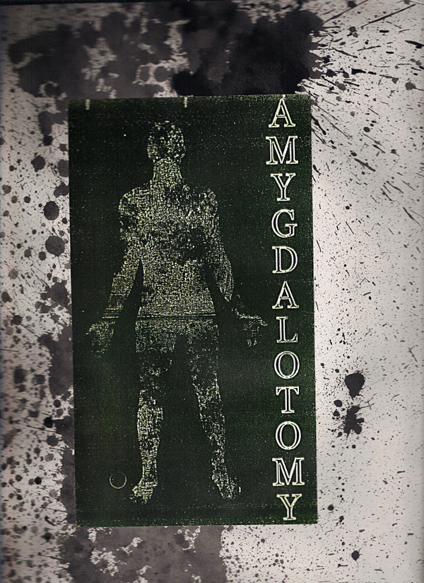 Amygdalotomy - Act IV