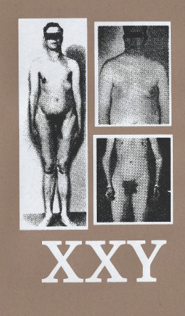 Baculum - Untitled