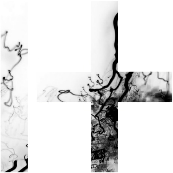 Black Arcade - Severed Lies