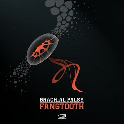 Brachial Palsy - Insanity Nerve (Remix By Phelios)