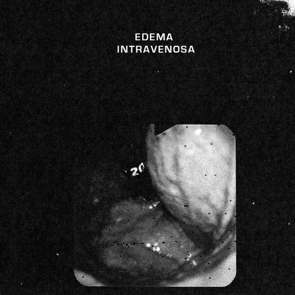 Edema Intravenosa - Victims Of Apathy