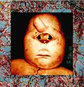 Fetus Productions - State To Be In