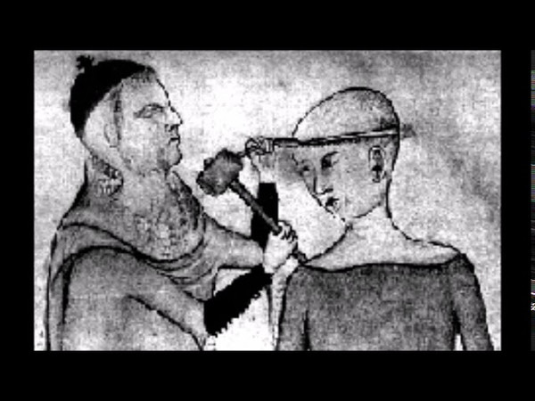 Labia Minora - Halt