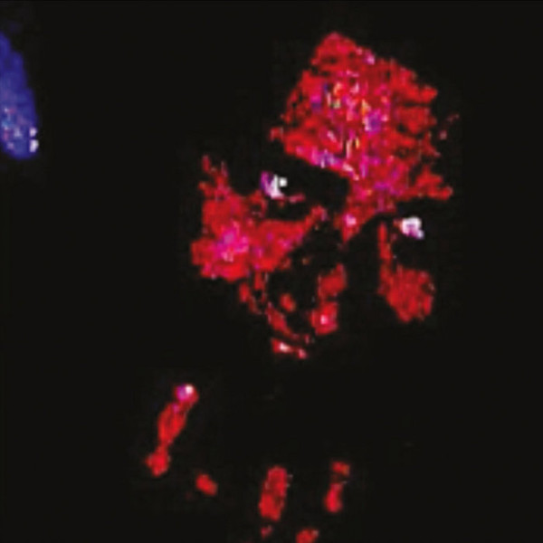 Lunar Emotzia - Festival Noise of Terror