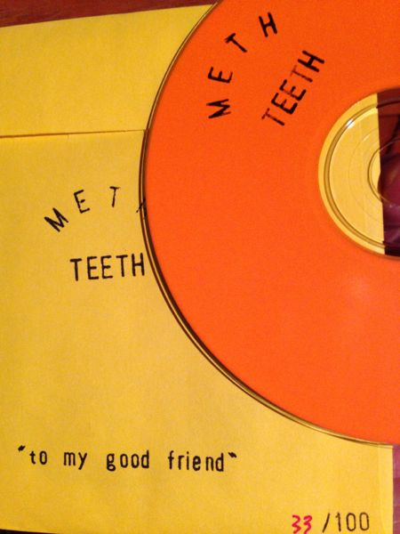 Meth Teeth - Bus Rides