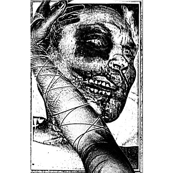Needle Fetish - Infirmary Introduction