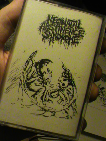Neonatal Abstinence Syndrome - Voracious Carnal Disease
