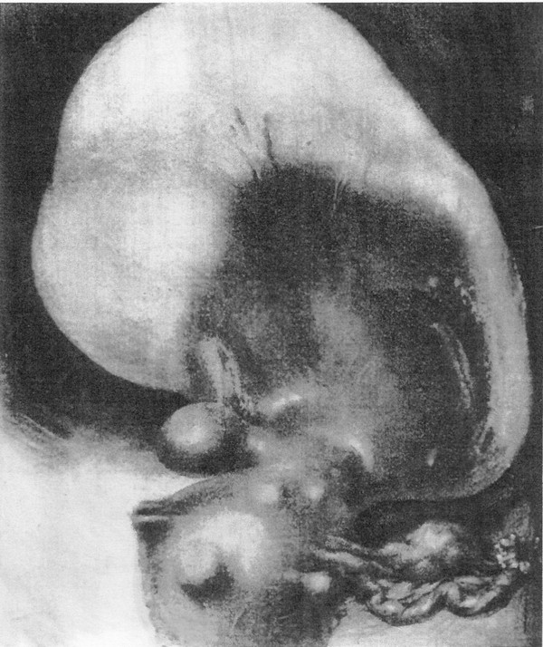SPITEFUL WOMB - Unsaid