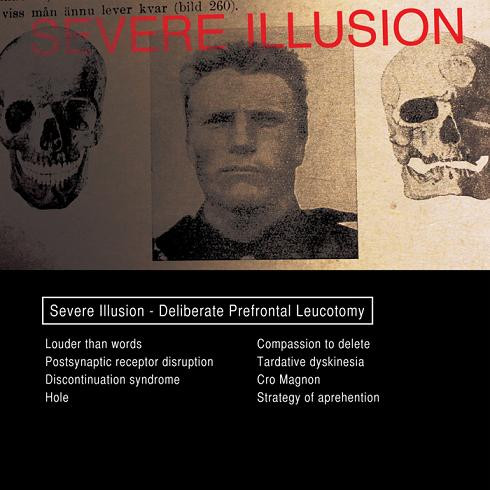 Severe Illusion - Movement