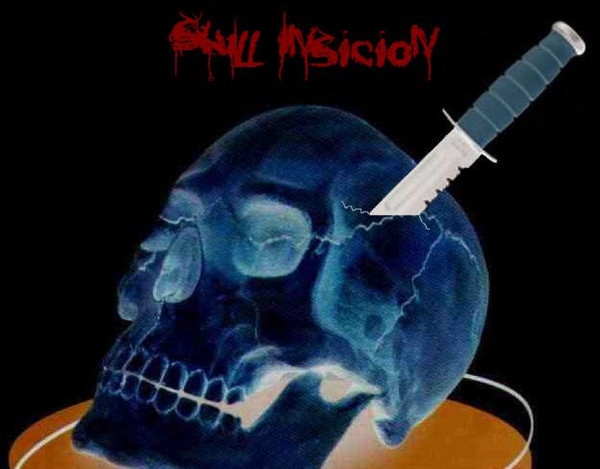Skull Incision - Diktat