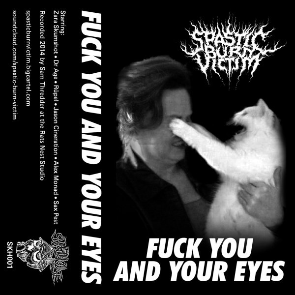 Spastic Burn Victim - Meat Wizard