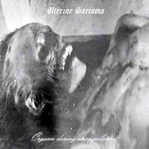 uterine sarcoma - the rotting corpse of a child